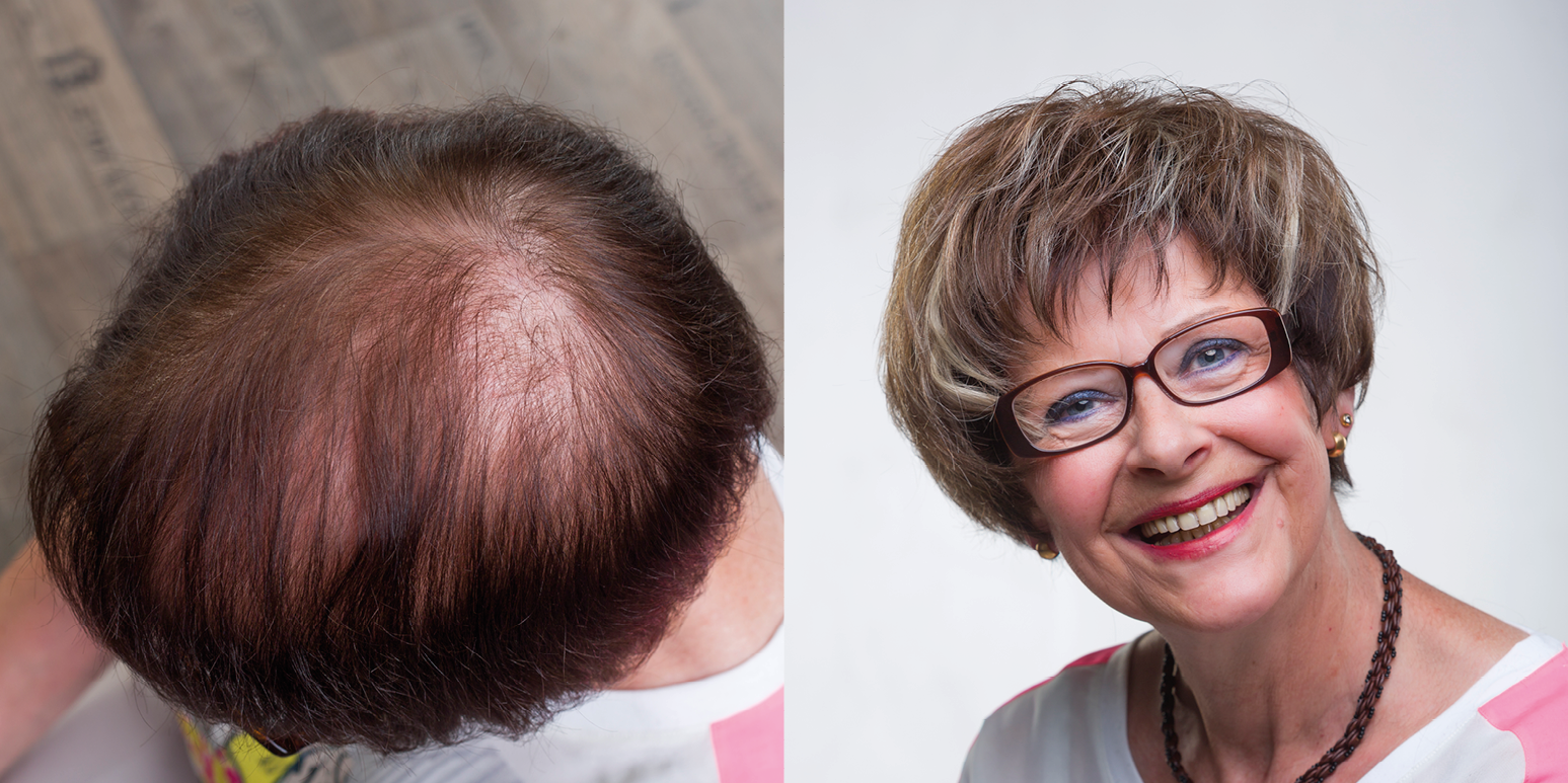 Haarteile, Toupets und Perücken für Männer und Frauen - Jürgen Imhof Zweithaarexperten aus Tauberbischofsheim