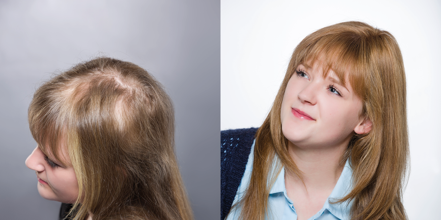 Haarteile, Toupets und Perücken für Männer und Frauen - Jürgen Imhof Zweithaarexperten aus Tauberbischofsheim