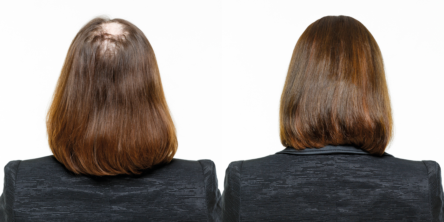 Haarteile, Toupets und Perücken für Männer und Frauen - Jürgen Imhof Zweithaarexperten aus Tauberbischofsheim